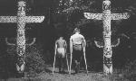 2 Boys on crutches walk between 2 totem poles