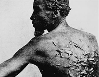 Photo of slave with large scars on his back from repeated whippings