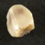 Mystery Tooth