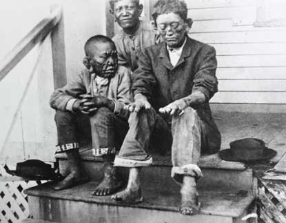 Young boys during early years at Kalawao.
