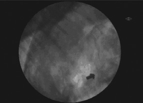 X-ray of deer carcass showing non-lead bullet in single piece