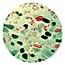 Microphoto of Hansen's disease spores.