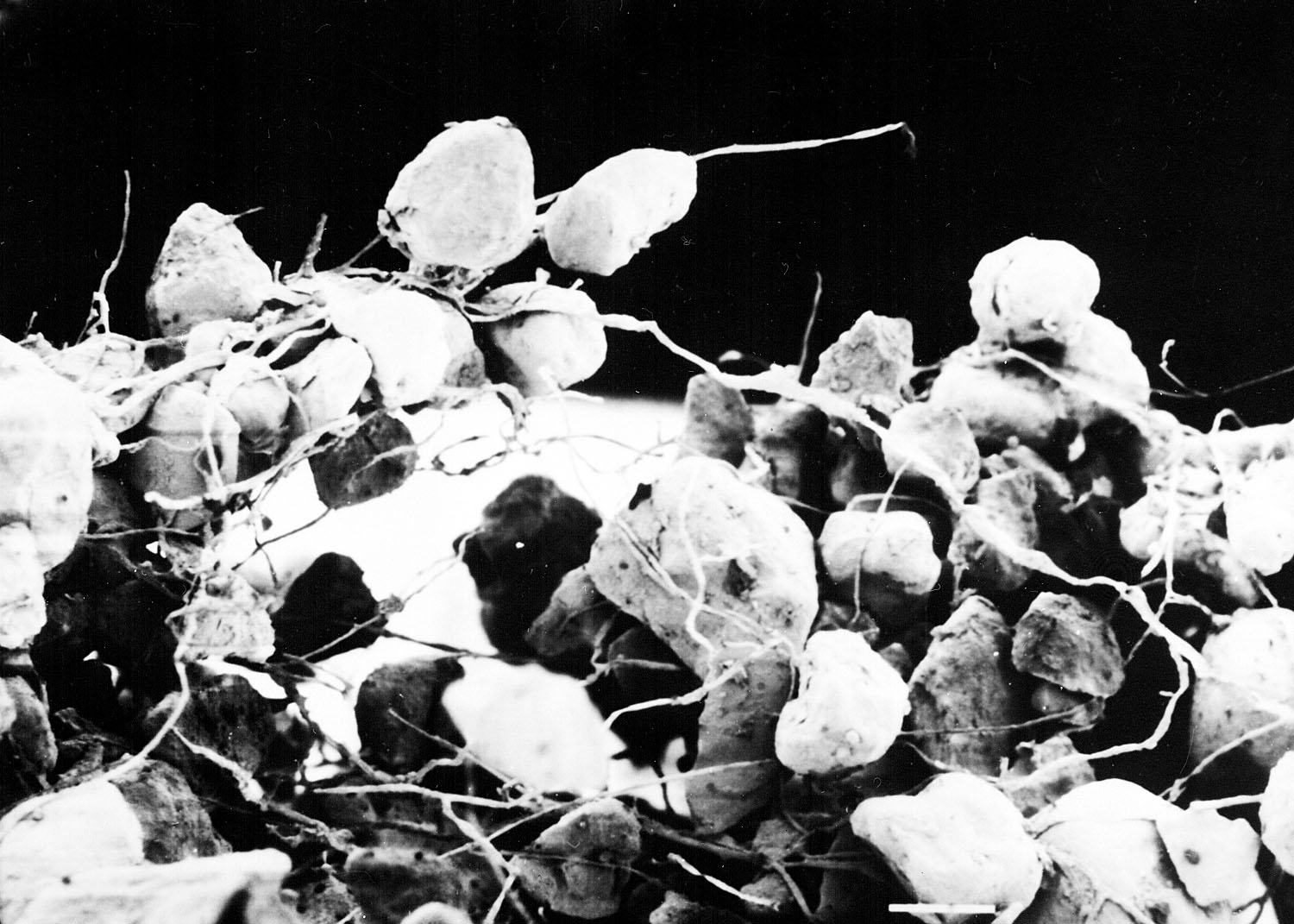 Black and white microscope image of many round lumpy particles being held together by thin white strands.