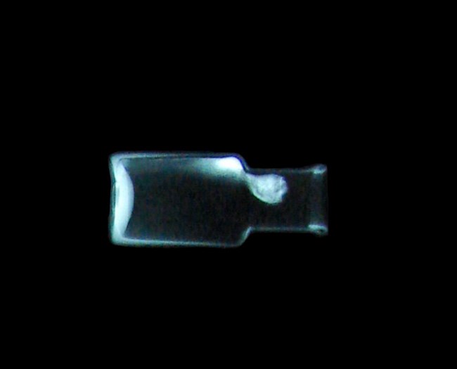 X-ray showing the medicine bottle. X-ray showing the mercury in the bottle. The mercury shows up on the x-ray due to high molecular weight.