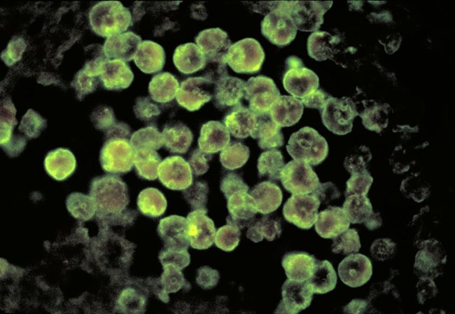 Direct fluorescent antibody staining of Naegleria fowleri parasite