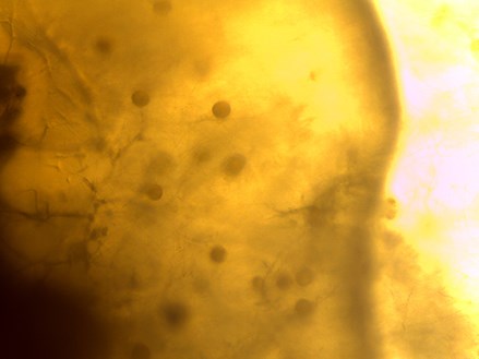 Phytophthora ramorum yellow leaf tissue with darker round spores viewed through a microscope
