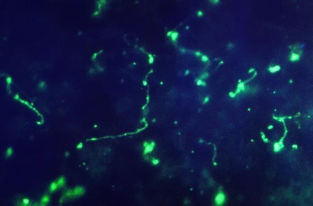 Leptospira from a human liver impression smear tissue sample Leptospira bacteria