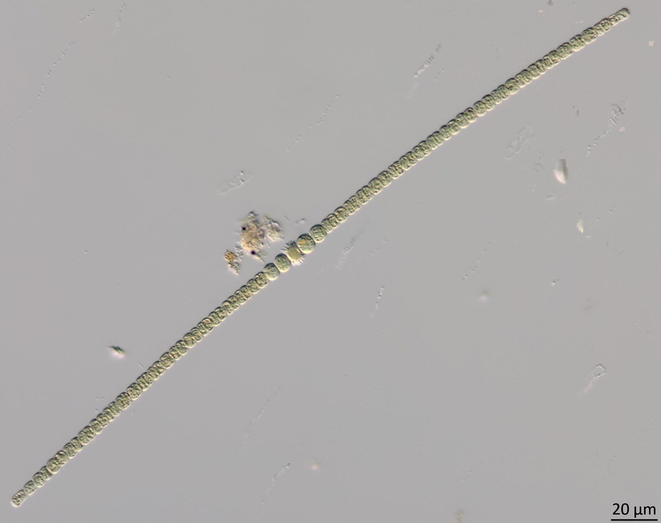 Microscope photo of a long, slender cyanobacterium.