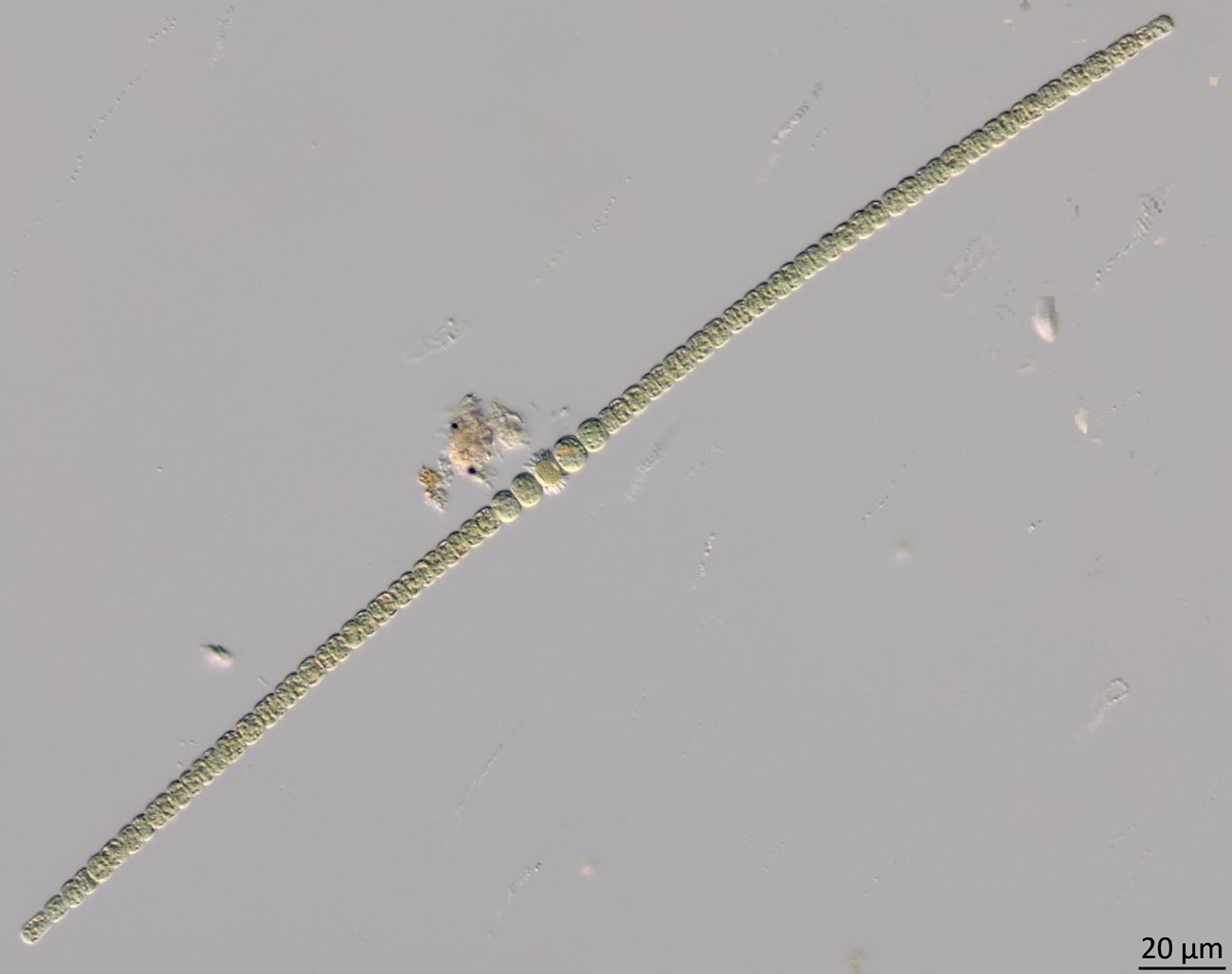 Sphaerospermopsis aphanizomenoides Microscope photo of a long, slender cyanobacterium.