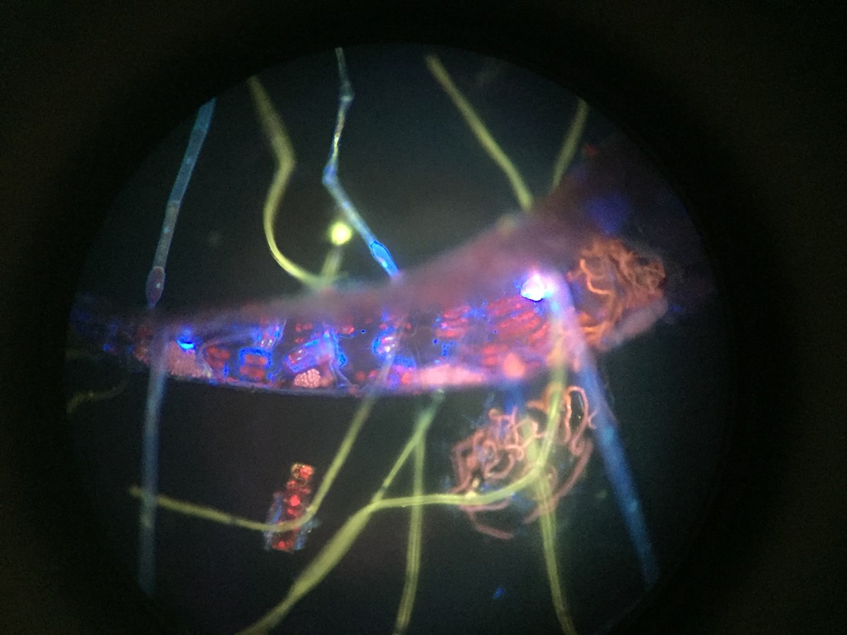 Microscopic moss leaf covered with microorganisms