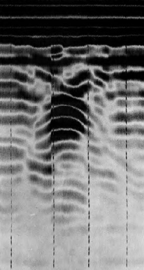 Radar profile image