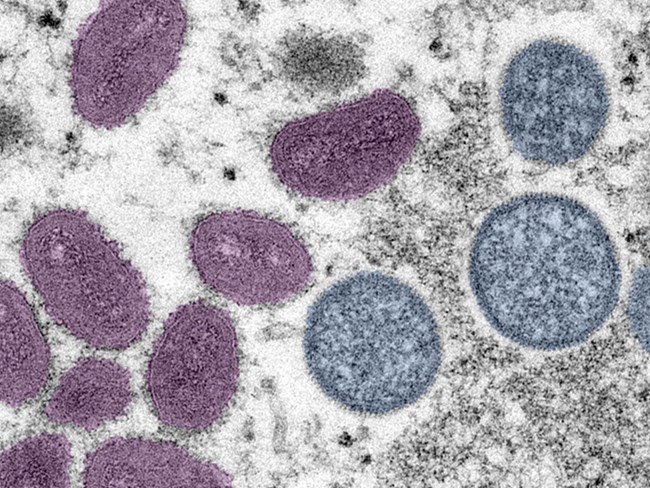 an image of the monkeypox virus