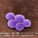 Staph aureus bacteria