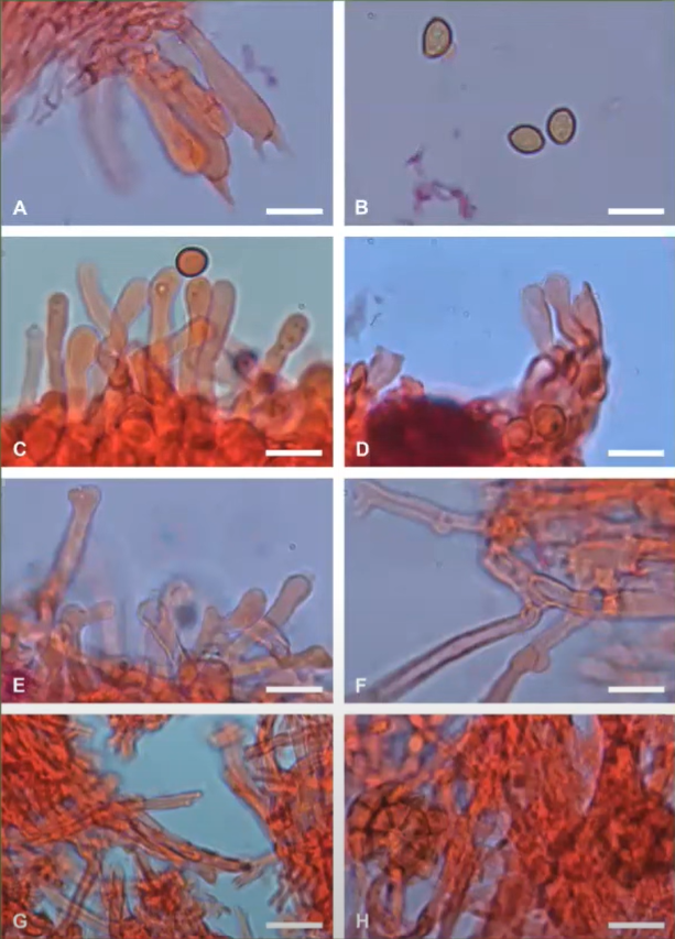microscopic images with red spindles and circles.