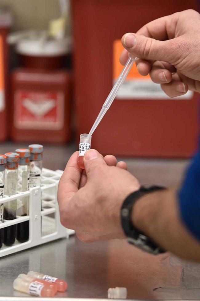 serum being transferred to pipettes