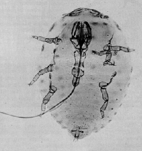Balsam woolly adelgid adult Microscope image of a balsam woolly adelgid adult