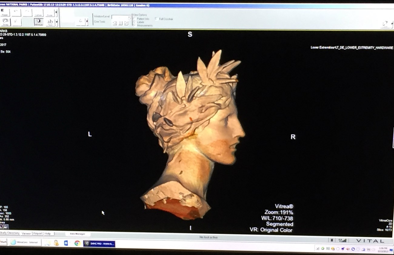 Profile image generated using a CT scanning device of a woman's face