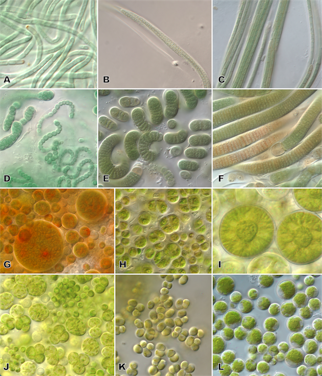 A graphic with thirteen microscopic images of cyanobacteria or eukaryotic algae A graphic with thirteen microscopic images of cyanobacteria or eukaryotic algae