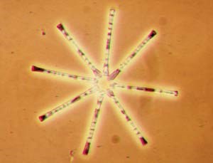 Diatom Diatoms such as this Asterionella have distinctive shapes that make them easy to identify.