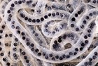 Boreal toad eggs