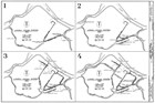 Evolution, canal system at Lowell, Historic American Engineering Record, Library of Congress.
