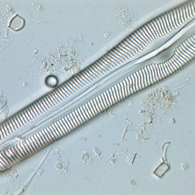 High-magnification image of a diatom shell