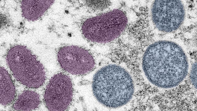 image of the monkeypox virus