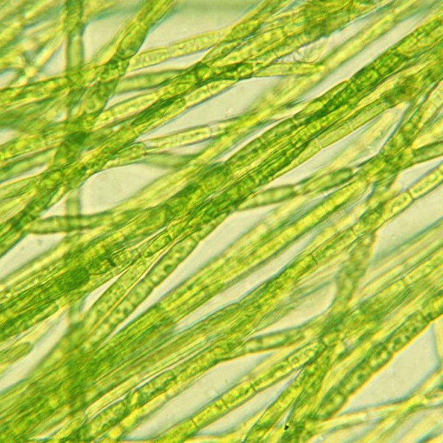 Algae under a microscope
