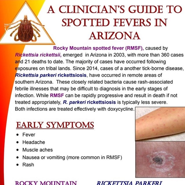 Rocky Mountain Spotted Fever 