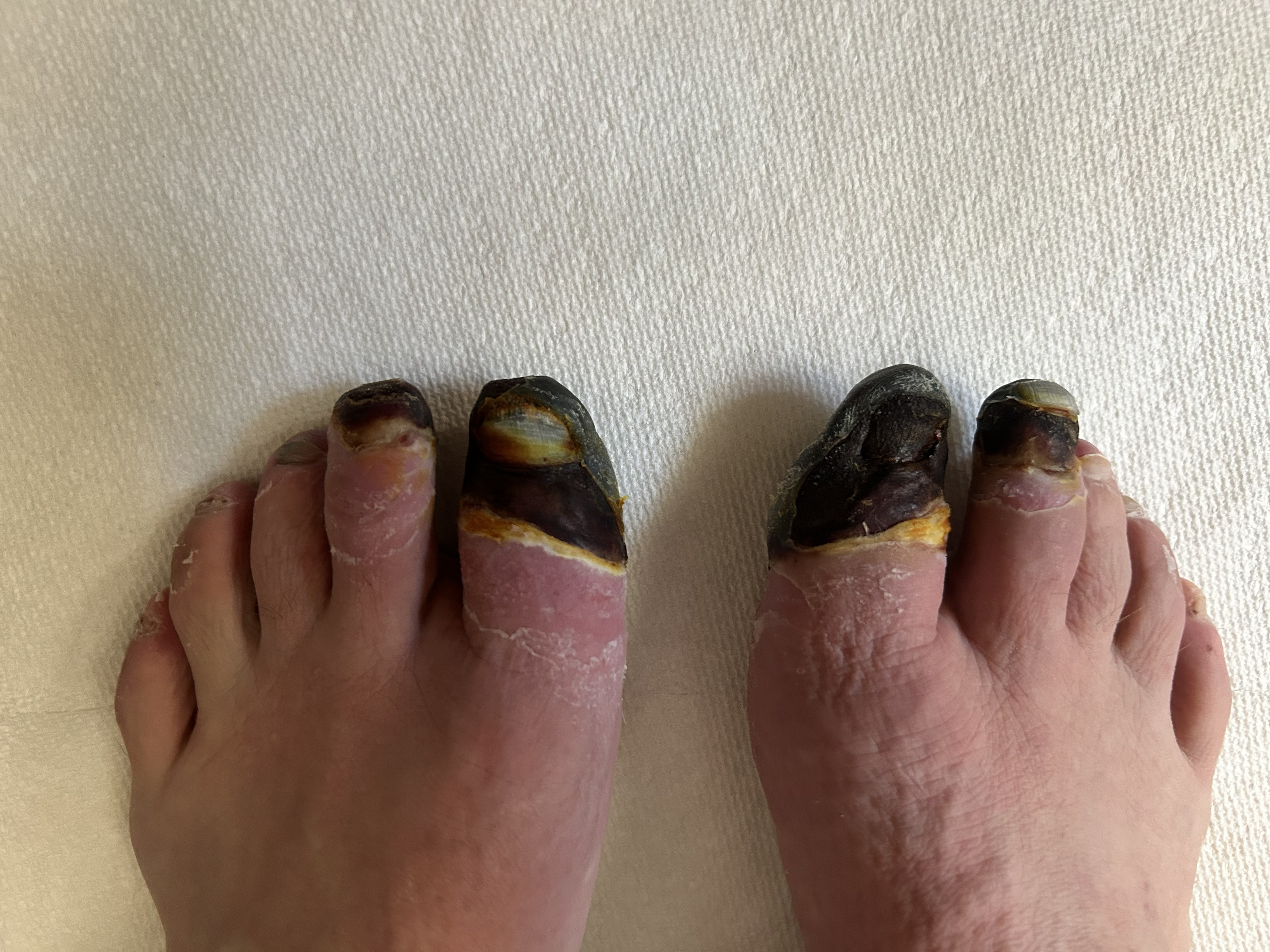 Necrotic tissue prior to amputation. Photo: G. Huey
