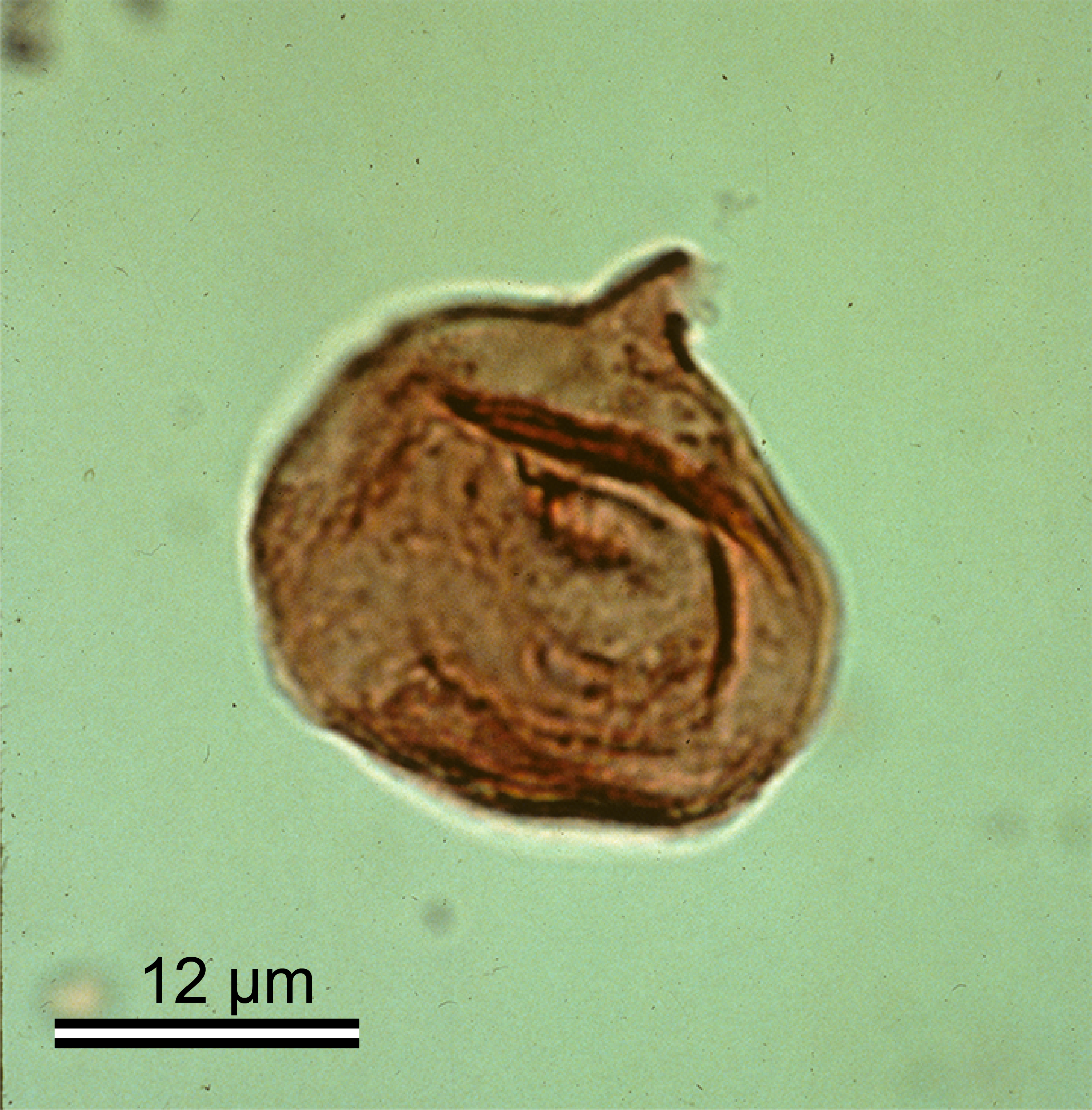 A single round pollen grain with a small pointed part on the top.