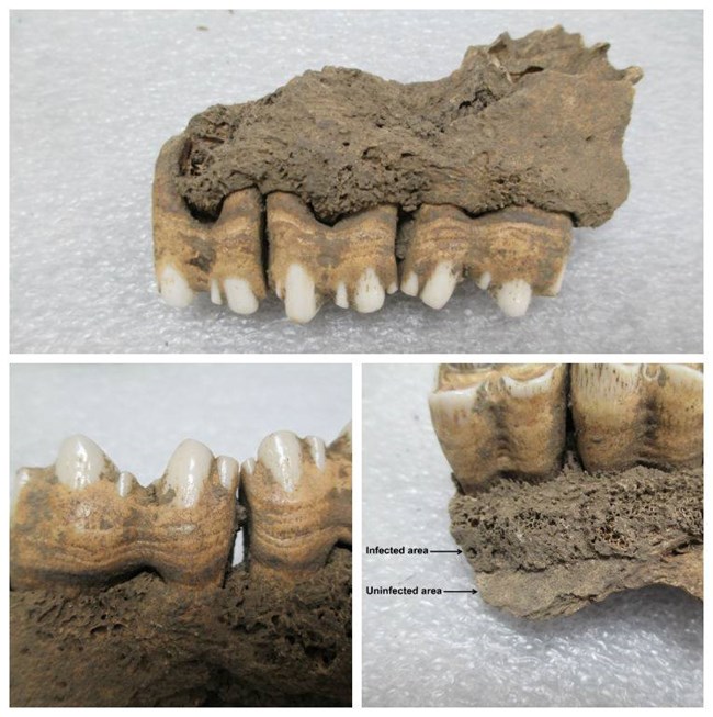 A pocked, jaw bone with teeth jutting out from it.
