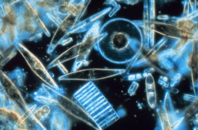 Bright blue transparent diatoms float in water under a microscope. There are football-shaped, sphere-shaped, and rod-shaped ones.