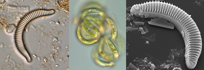 Three views of a microscopic diatom
