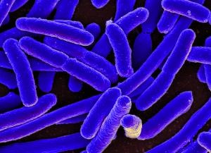 Image of E. coli through a microscope