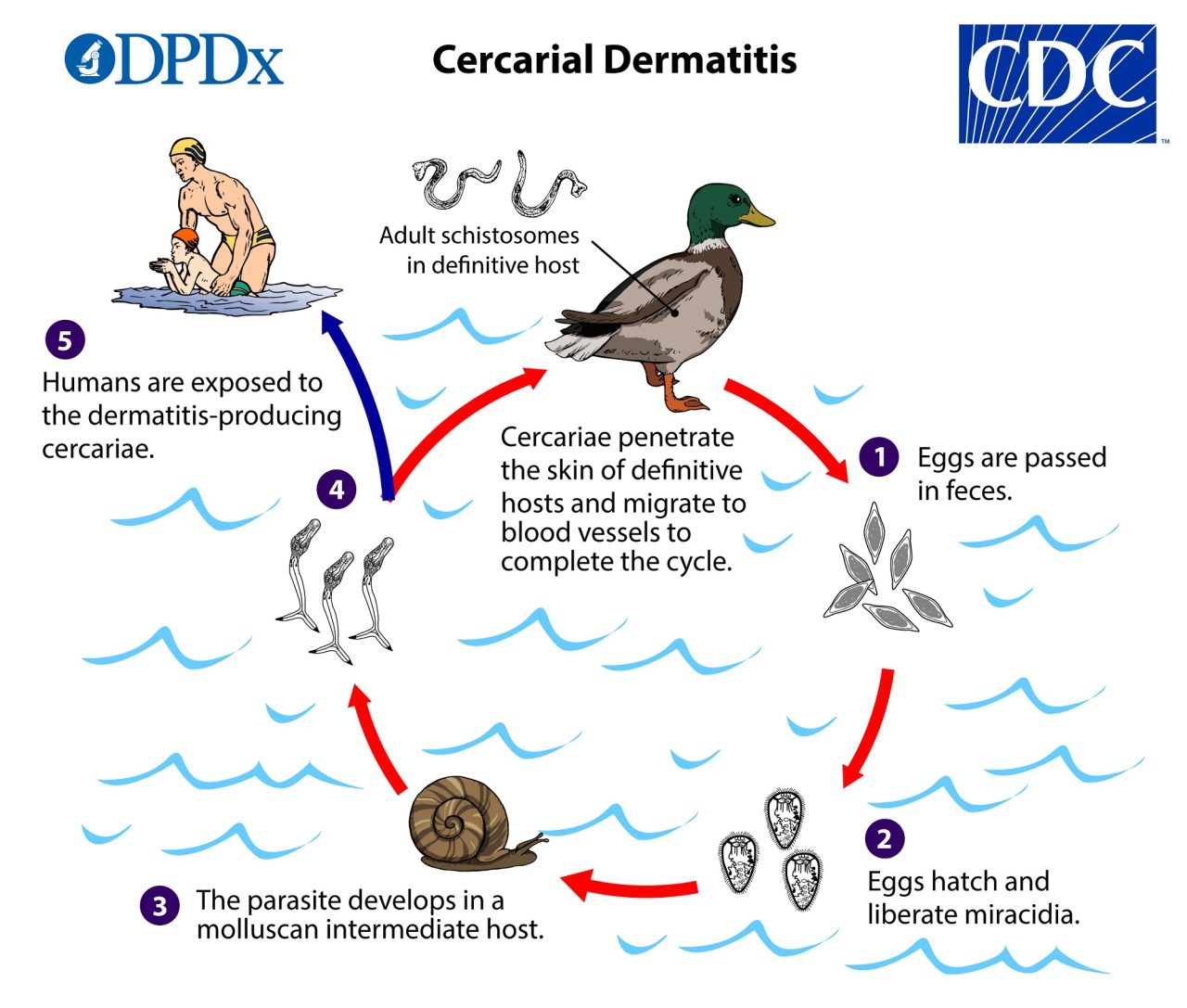Open Water Duck Rash Swimmer's Itch - Isle Royale National Park (U.S. National Park Service)