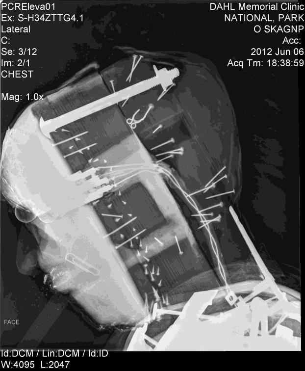 X-Ray image of historic manican