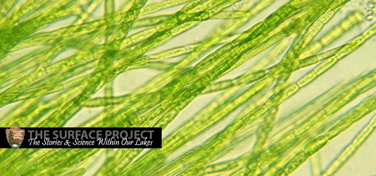 Algae viewed under a microscope