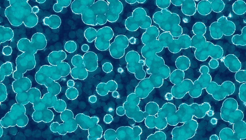 Microcystis Microcystis