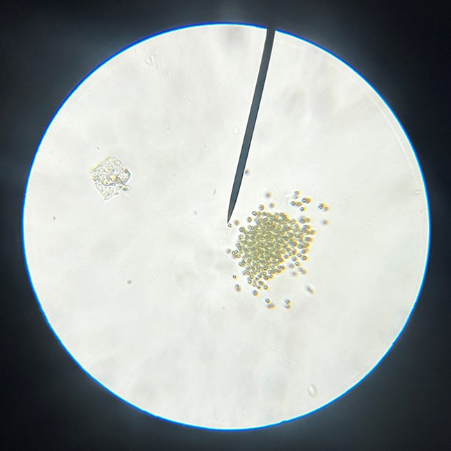 HAB microscope view
