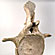 Vertebra