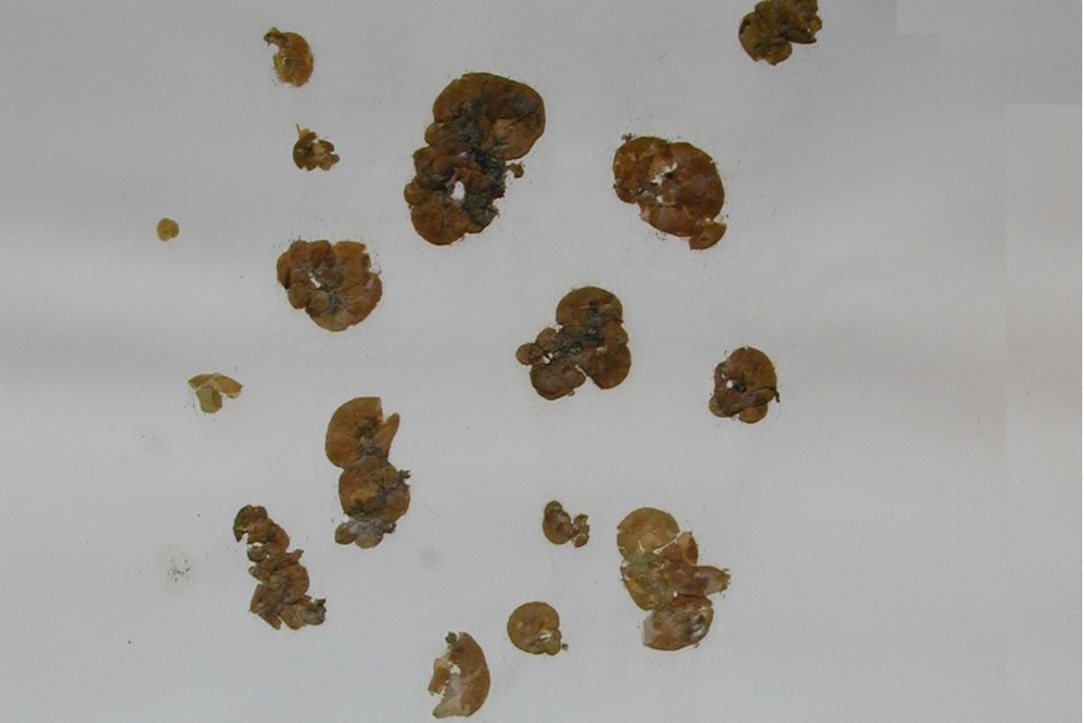 Small, globular pieces of seaweed.