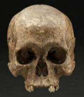 A skull reportedly found near Gettysburg National Military Park is not that of a Civil War soldier. Smithsonian National Museum photo by D Hurlbert.