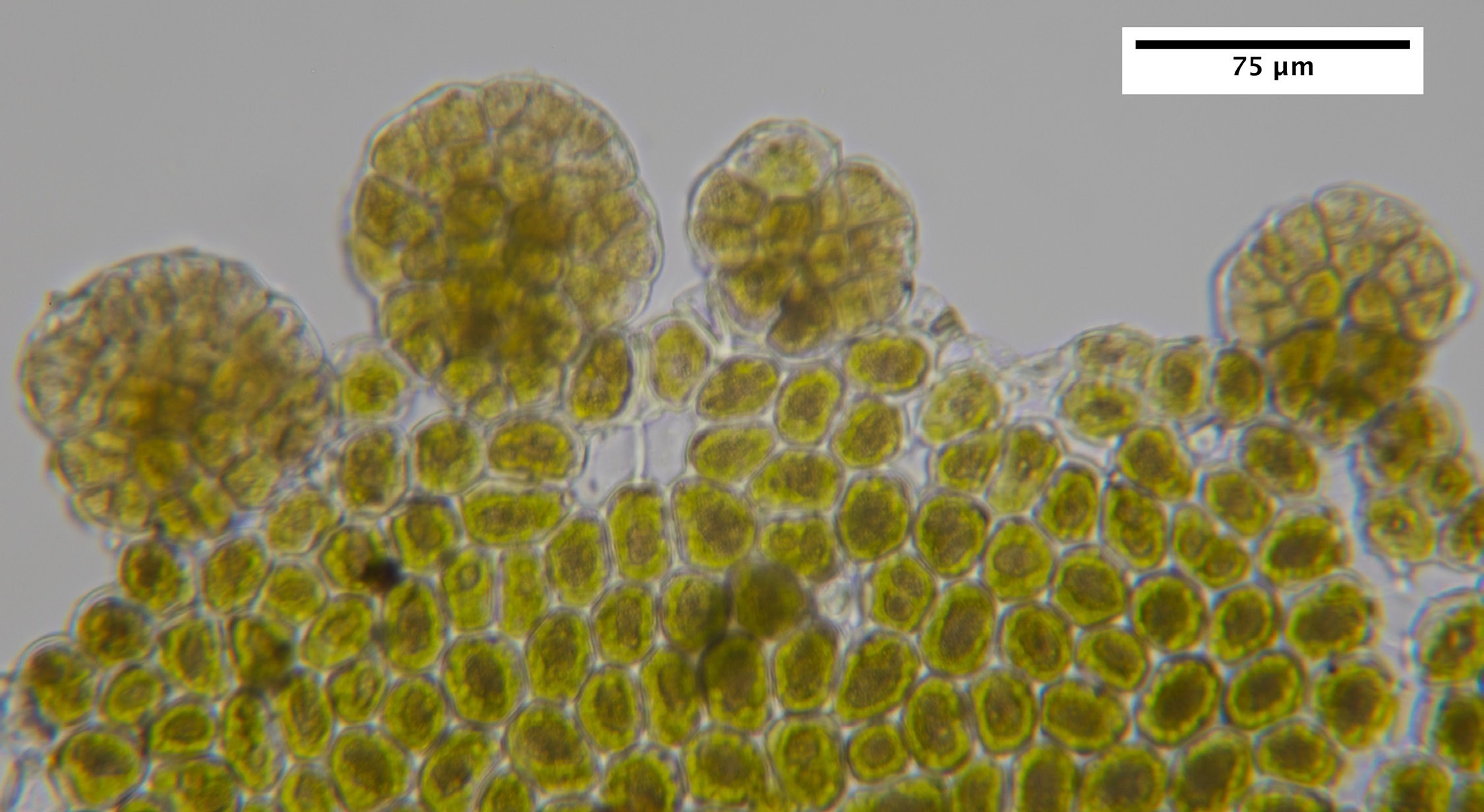 Microscopic view of olive green clusters of reproductive cells located on the margin of a Radula complanata.