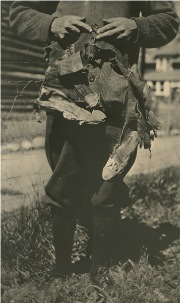 a photo of man struck by lightening