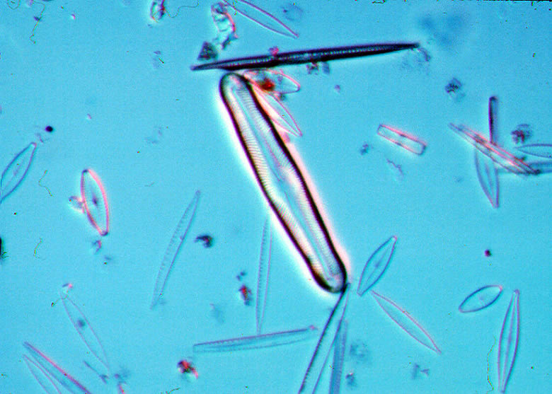 a photo of Pinnularia mesogongyla