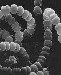 a photo of Anabaena flos-aquae (Lyng.) Breb.