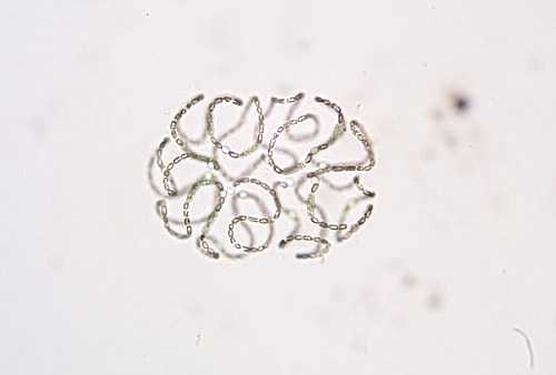 a photo of Anabaena sp.colony a photo of Anabaena sp.colony