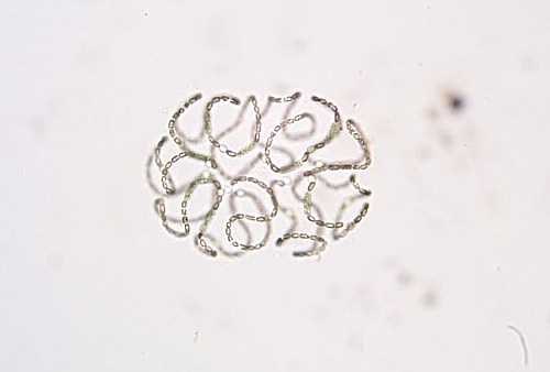 a photo of Anabaena sp.colony