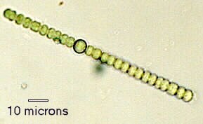 a photo of Filament of Anabaena sp.